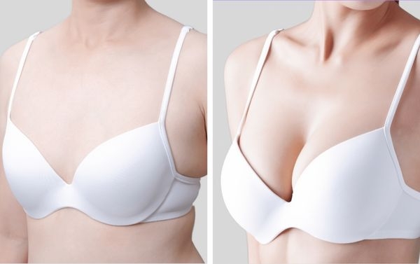 Breast surgery